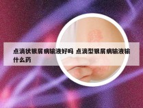 点滴状银屑病输液好吗 点滴型银屑病输液输什么药