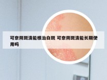 可奈阴斑清能根治白斑 可奈阴斑清能长期使用吗