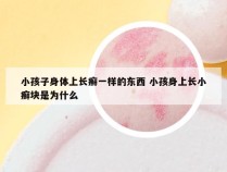 小孩子身体上长癣一样的东西 小孩身上长小癣块是为什么