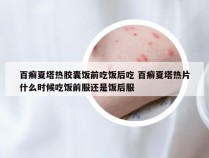 百癣夏塔热胶囊饭前吃饭后吃 百癣夏塔热片什么时候吃饭前服还是饭后服