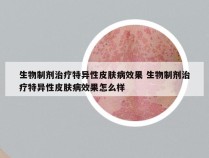 生物制剂治疗特异性皮肤病效果 生物制剂治疗特异性皮肤病效果怎么样