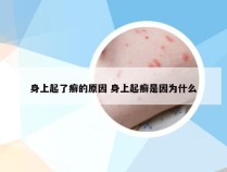 身上起了癣的原因 身上起癣是因为什么