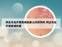 阿达木治疗银屑病首都儿科研究所 阿达木治疗银屑病效果