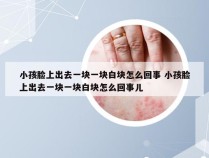 小孩脸上出去一块一块白块怎么回事 小孩脸上出去一块一块白块怎么回事儿