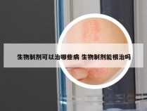 生物制剂可以治哪些病 生物制剂能根治吗