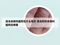 南充皮肤科医院在什么地方 南充好的皮肤科医院在哪里