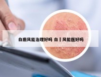 白廒风能治理好吗 白壂风能医好吗