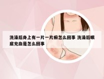 洗澡后身上有一片一片癣怎么回事 洗澡后眼底充血是怎么回事