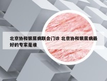 北京协和银屑病联合门诊 北京协和银屑病最好的专家是谁