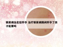 银屑病治愈后怀孕 治疗银屑病期间怀孕了孩子能要吗