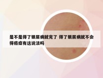 是不是得了银屑病就完了 得了银屑病就不会得癌症有这说法吗