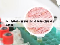 身上有块癣一直不好 身上有块癣一直不好怎么回事