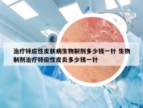 治疗特应性皮肤病生物制剂多少钱一针 生物制剂治疗特应性皮炎多少钱一针