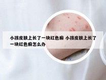 小孩皮肤上长了一块红色癣 小孩皮肤上长了一块红色癣怎么办