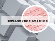 刚出生小孩博子有白点 新生儿有小白点