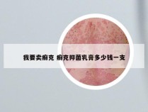 我要卖癣克 癣克抑菌乳膏多少钱一支