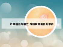 白颠病治疗偏方 白颠疯病用什么中药