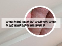 生物制剂治疗皮肤病会产生依赖性吗 生物制剂治疗皮肤病会产生依赖性吗知乎