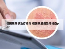 德国银屑病治疗指南 德国银屑病治疗指南pdf