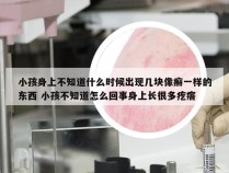 小孩身上不知道什么时候出现几块像癣一样的东西 小孩不知道怎么回事身上长很多疙瘩