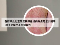 在脖子处比正常皮肤颜色浅的白点是怎么回事 脖子上肤色不均匀白色