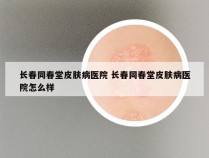 长春同春堂皮肤病医院 长春同春堂皮肤病医院怎么样