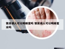 银肖病人可以喝蜂蜜吗 银屑病人可以喝蜂蜜水吗