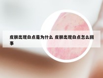 皮肤出现白点是为什么 皮肤出现白点怎么回事