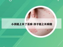 小孩腿上长了苔癣 孩子腿上长癣图