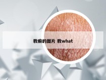 教癣的图片 教what