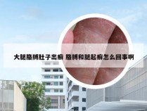 大腿胳膊肚子出癣 胳膊和腿起癣怎么回事啊