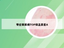 枣庄银屑病TOP级孟晨星A