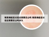 银屑病痊愈以后还需要忌口吗 银屑病痊愈以后还需要忌口吗多久