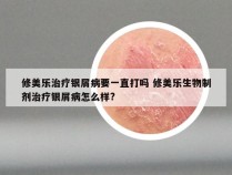 修美乐治疗银屑病要一直打吗 修美乐生物制剂治疗银屑病怎么样?