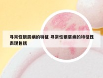 寻常性银屑病的特征 寻常性银屑病的特征性表现包括