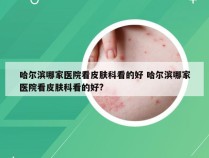 哈尔滨哪家医院看皮肤科看的好 哈尔滨哪家医院看皮肤科看的好?