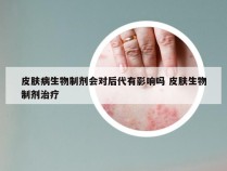 皮肤病生物制剂会对后代有影响吗 皮肤生物制剂治疗