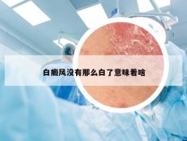 白癜风没有那么白了意味着啥