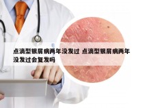 点滴型银屑病两年没发过 点滴型银屑病两年没发过会复发吗