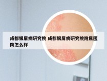 成都银屑病研究院 成都银屑病研究院附属医院怎么样