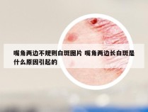 嘴角两边不规则白斑图片 嘴角两边长白斑是什么原因引起的