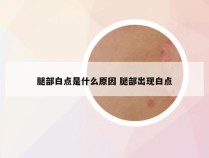 腿部白点是什么原因 腿部出现白点