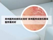 郑州医院皮肤科比较好 郑州医院皮肤科那家医院看的好