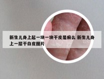 新生儿身上起一块一块干皮是癣么 新生儿身上一层干白皮图片