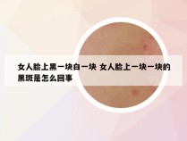 女人脸上黑一块白一块 女人脸上一块一块的黑斑是怎么回事