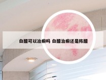 白醋可以冶癣吗 白醋治癣还是陈醋