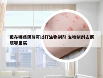 现在哪些医院可以打生物制剂 生物制剂去医院哪里买