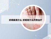 疥螨癣用什么 疥螨用什么药物治疗