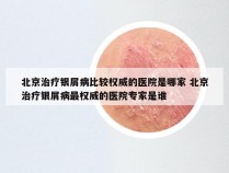 北京治疗银屑病比较权威的医院是哪家 北京治疗银屑病最权威的医院专家是谁