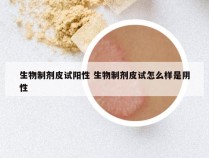 生物制剂皮试阳性 生物制剂皮试怎么样是阴性